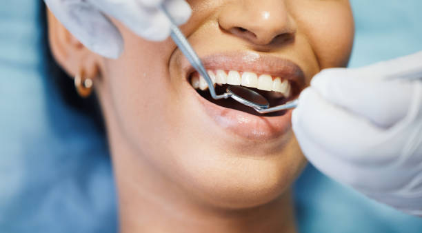 Best Pediatric Emergency Dentist in Baldwin, LA