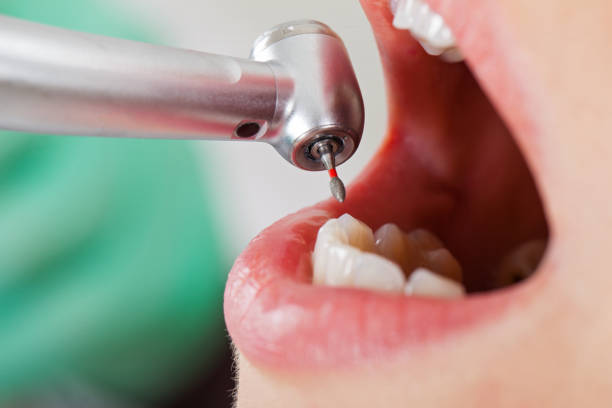 Best Emergency Treatment for Toothache in Baldwin, LA